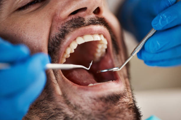 Best Pediatric Emergency Dentist in West Carthage, NY